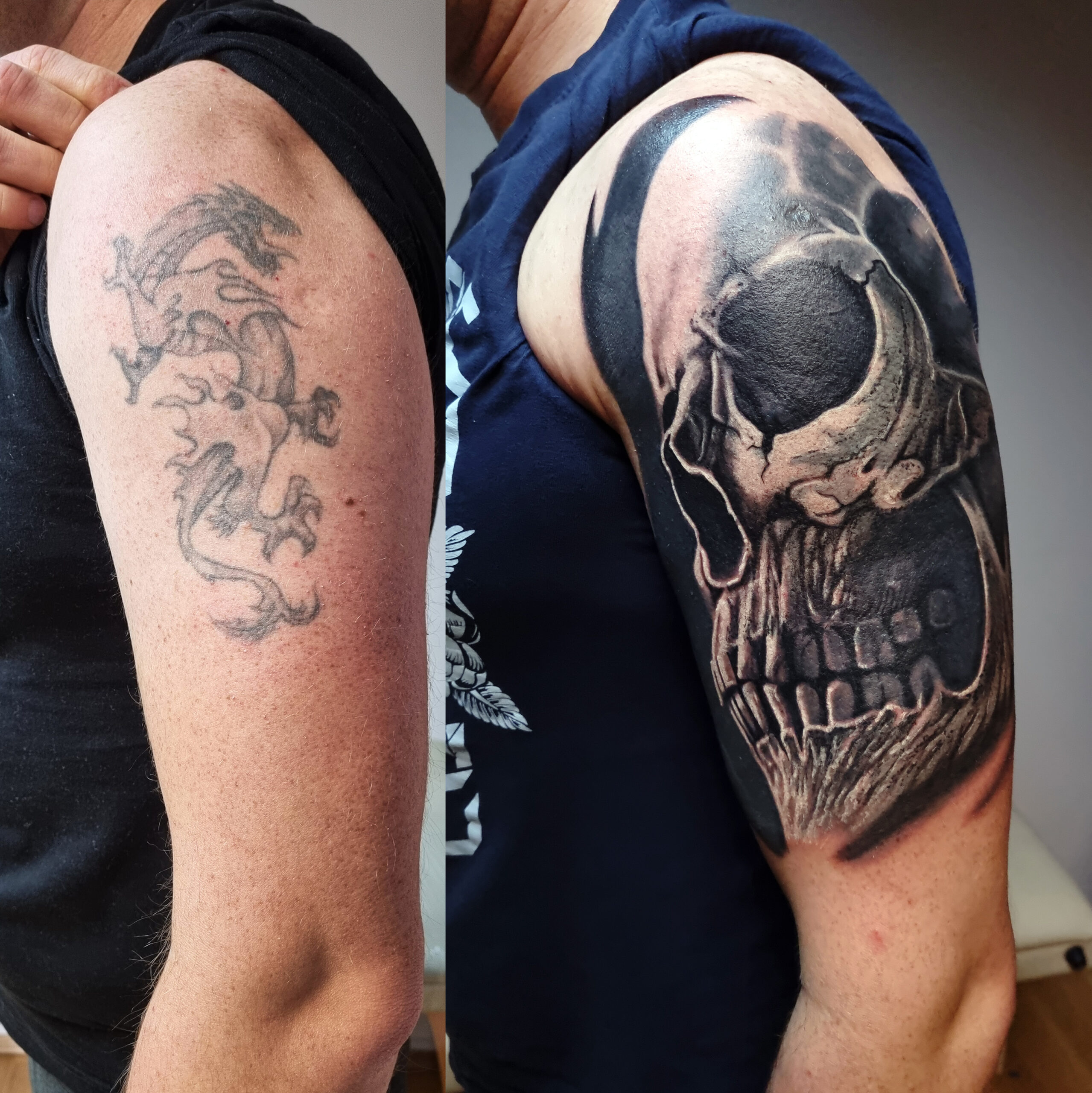 Skull cover-up